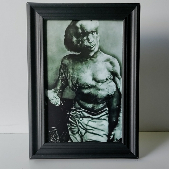 elephant man john merrick Freakshow Sideshow Carnival Circus Oddity Framed Photo - Picture 3 of 3